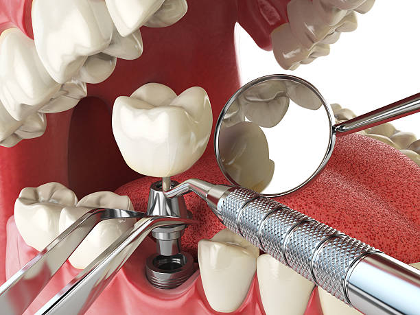 Best Emergency Broken Tooth Repair in Langston, OK